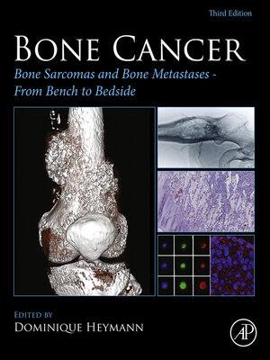 cover image of Bone Cancer
